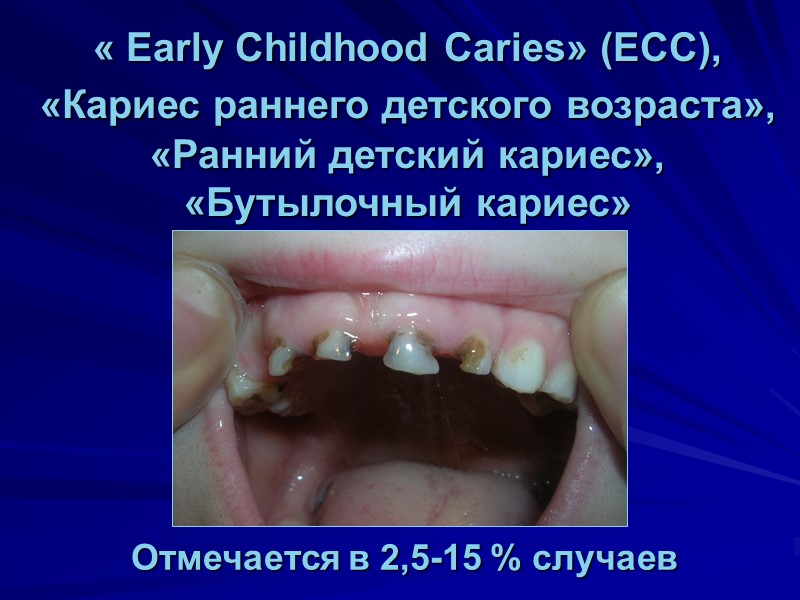 « Early Childhood Caries» (ECC), «Кариес раннего детского возраста»,  «Ранний детский кариес», «Бутылочный